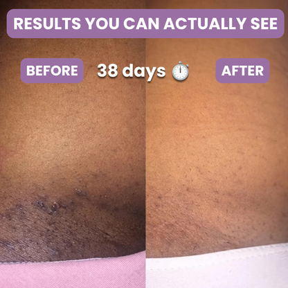 Revia Mandelic Acid Serum